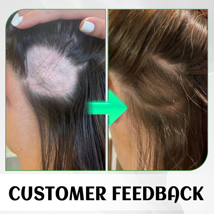 Biancat™ FolliHerb Hair Growth Spray