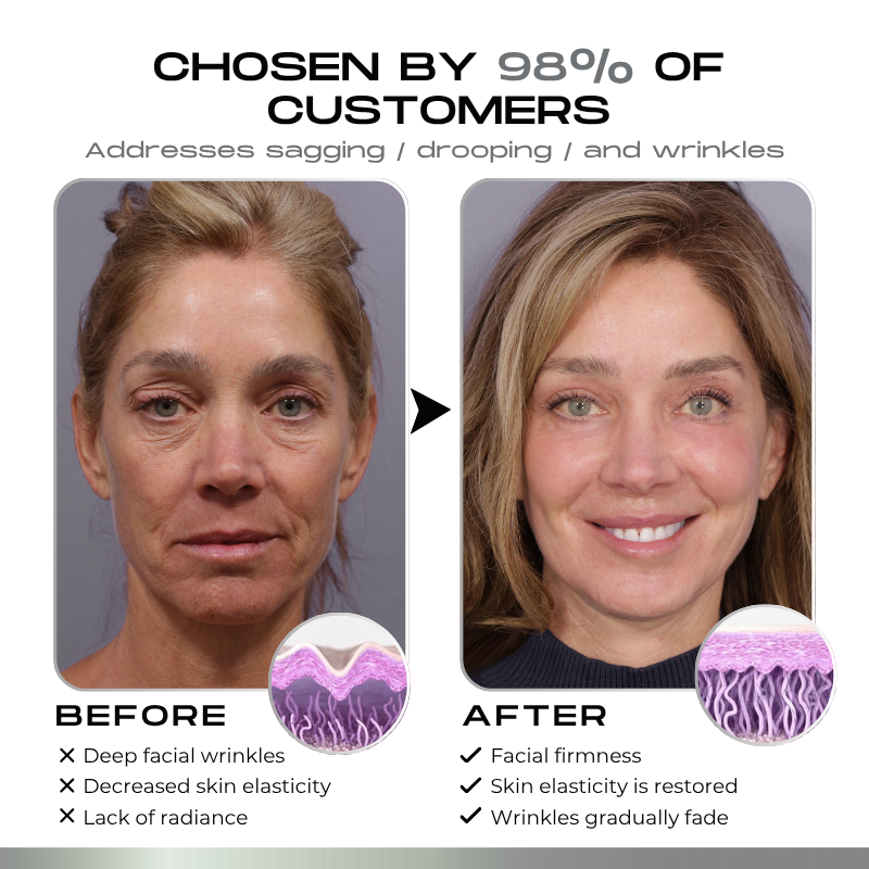 Timilk® SnapLift Instant Face Tightening Serum