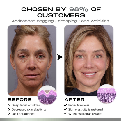 Timilk® SnapLift Instant Face Tightening Serum