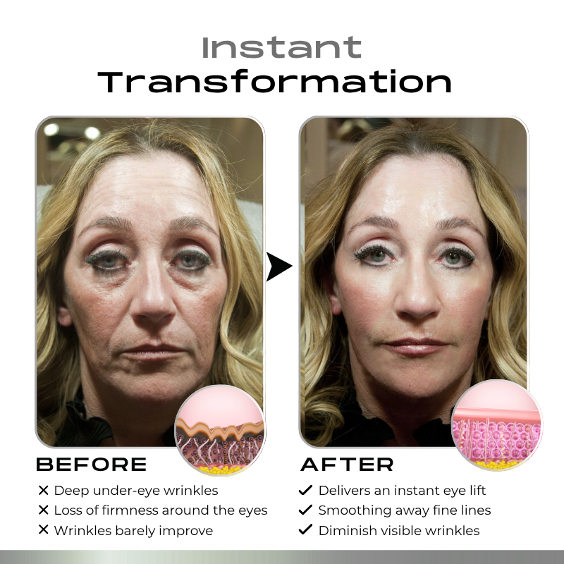 Timilk® SnapLift Instant Face Tightening Serum