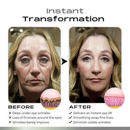 Timilk® SnapLift Instant Face Tightening Serum