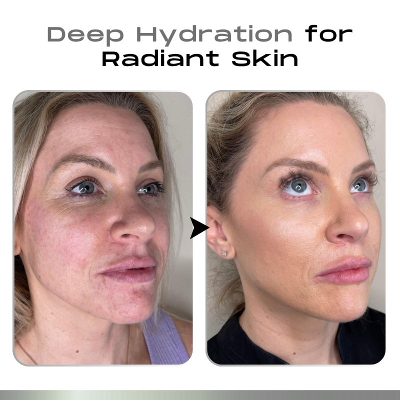 Timilk® SnapLift Instant Face Tightening Serum