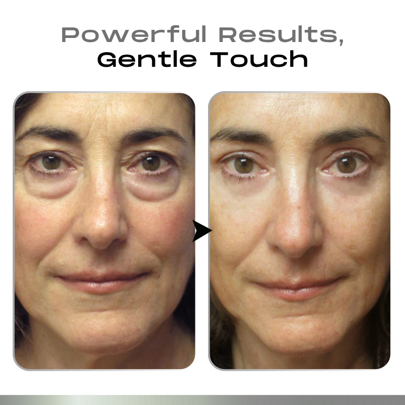 Timilk® SnapLift Instant Face Tightening Serum