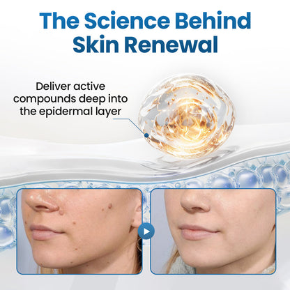 Biancat® BumpFlatten Cream