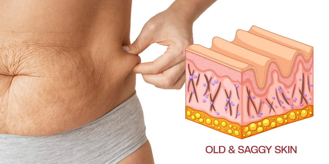 Timilk® AuréLuxe Body Firming Oil