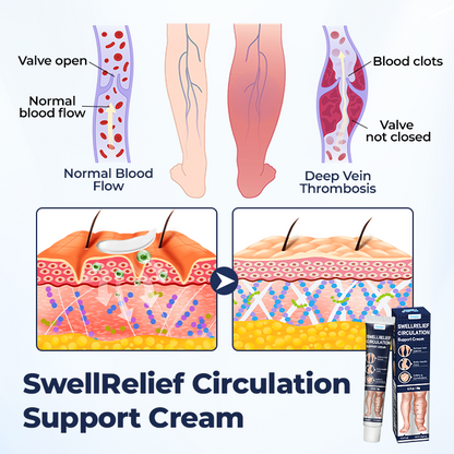 Timilk® SwellRelief Circulation Support Cream