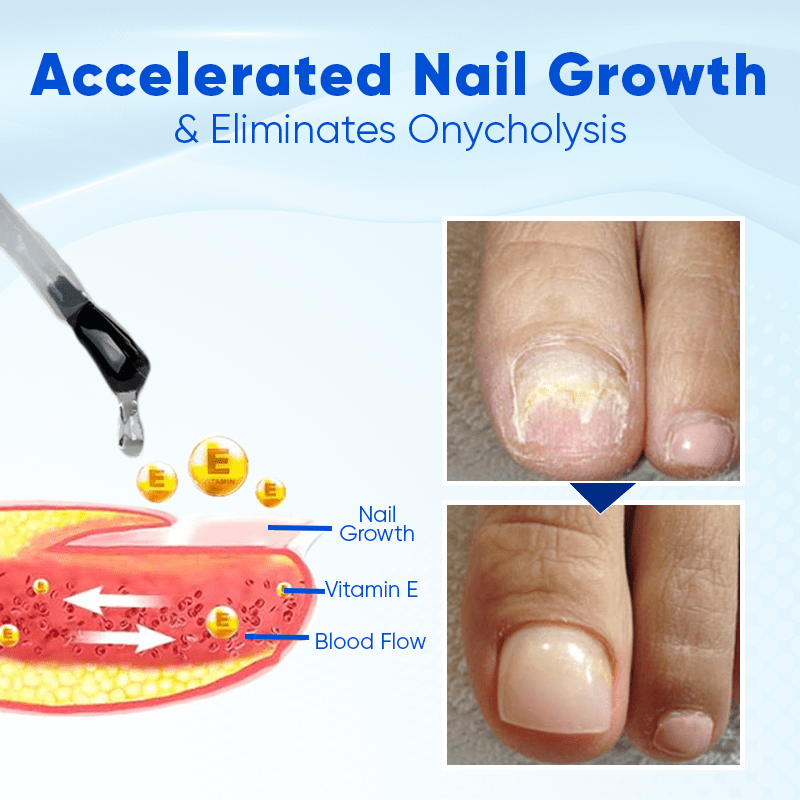 Biancat™ OnyxoGuard Nail Growth and Repair Serum English JVJM 