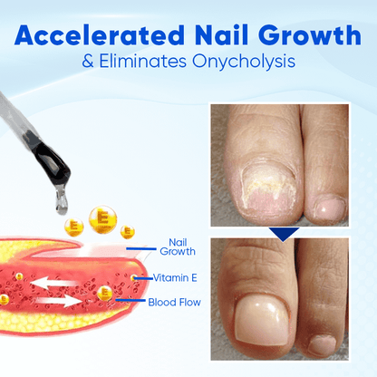 Biancat™ OnyxoGuard Nail Growth and Repair Serum English JVJM 