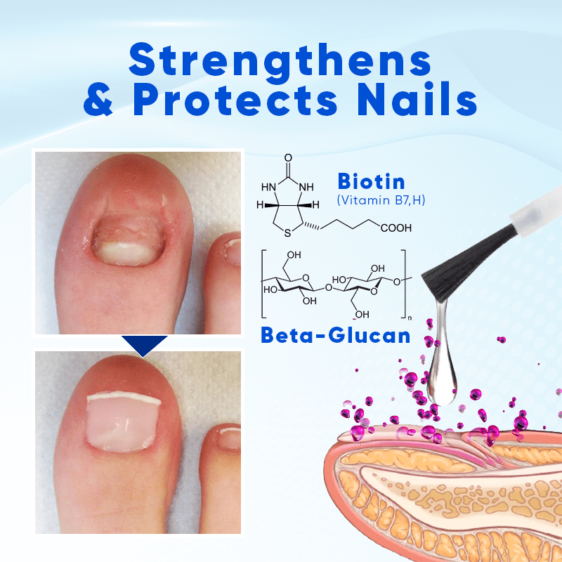 Biancat™ OnyxoGuard Nail Growth and Repair Serum English JVJM 